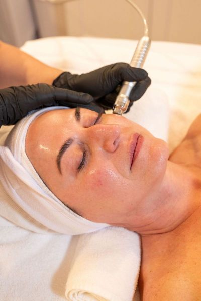 hydrodermabrasion-facial
