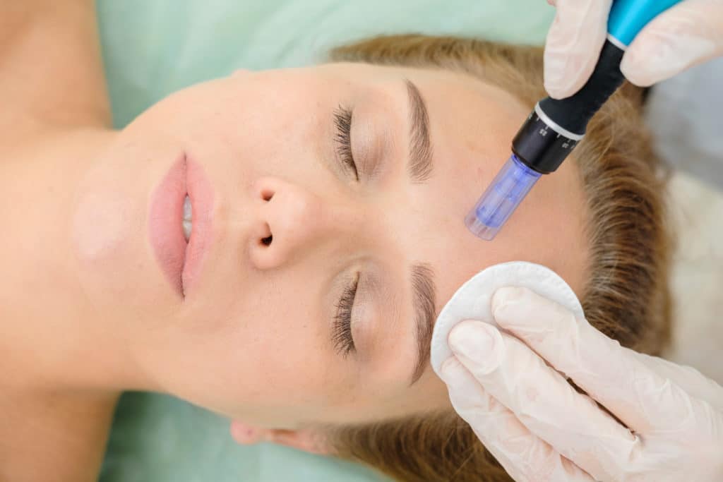 Athetik Microneedling