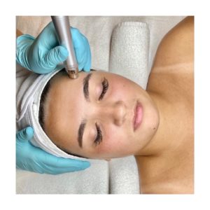 Hydradermabrasion asthetik spa punta gorda florida