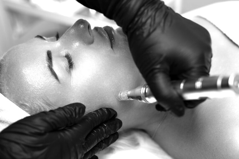 Microneedle RF lifting procedure. A cosmetologist performs a facial rejuvenation procedure on a woman. Hardware cosmetology
