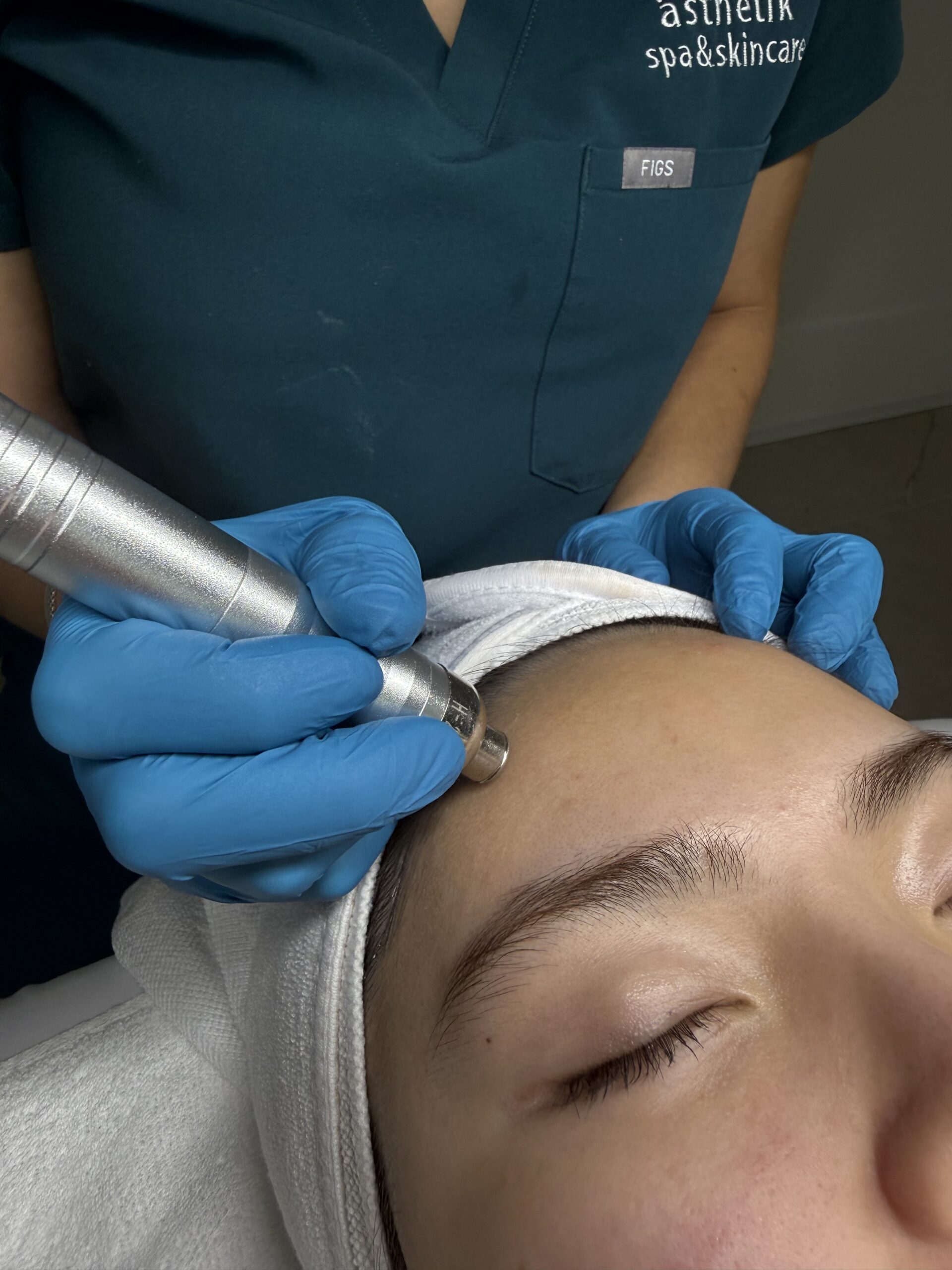 ästhetik spa & skincare esthetician performing a microdermabrasion treatment with a diamond-tip handpiece on a client's forehead