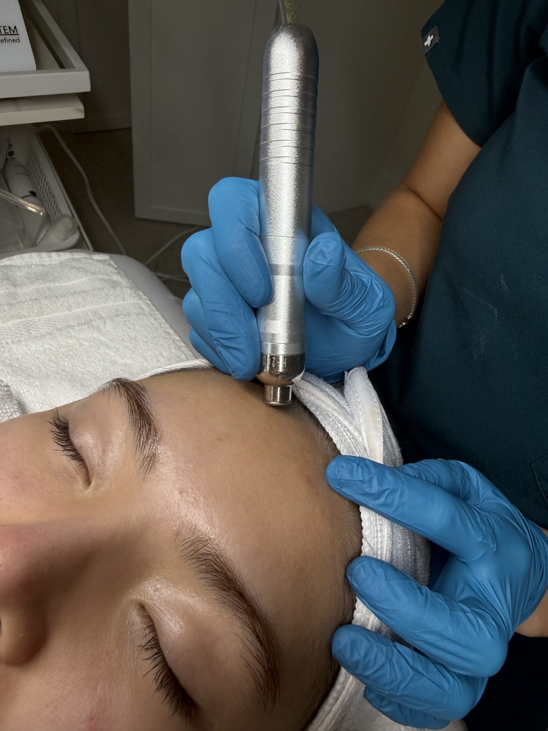 Close view of the diamond-tip microdermabrasion handpiece used during treatment at ästhetik spa & skincare